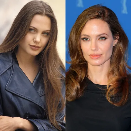 Анджелина Джоли до и после