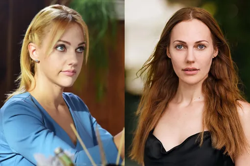 Турецкая актриса Мерьем Узерли до и после пластики