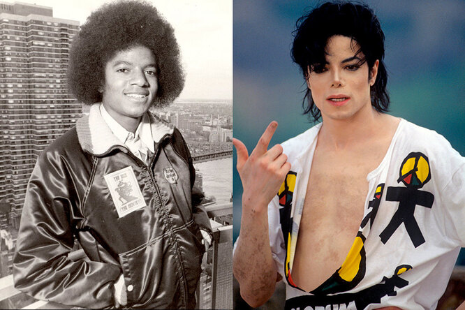 Майкл Джексон до и после пластики
