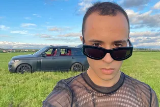 Слава Марлоу показал результат пересадки волос Слава Марлоу показал результат пересадки волос