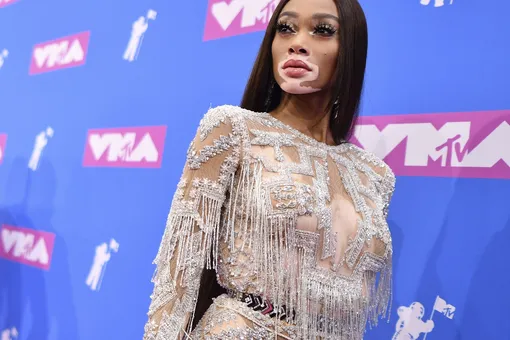 Модель с витилиго Винни Харлоу стала новым «ангелом» Victoria’s Secret Модель с витилиго Винни Харлоу стала новым «ангелом» Victoria’s Secret