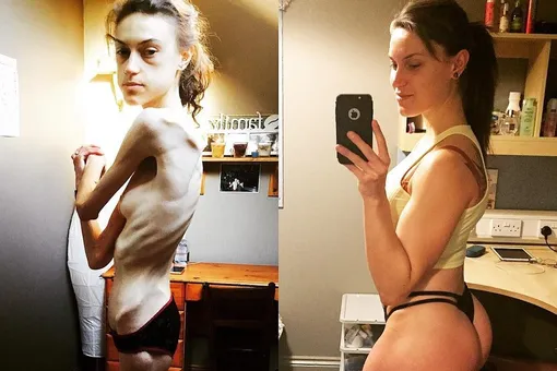 Популярная блогер показала, как Instagram* помог ей победить анорексию