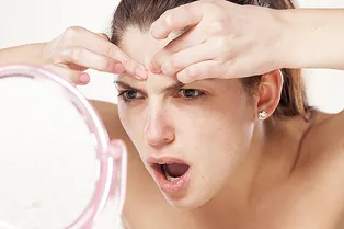 Топ-5 народных средств от прыщей, которые сделают только хуже Топ-5 народных средств от прыщей, которые сделают только хуже