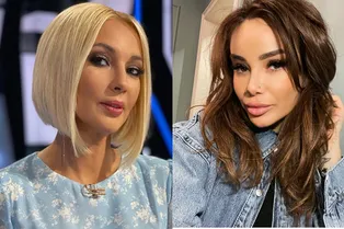 Звезды, которые хотели улучшить внешность, но вместо этого подорвали здоровье