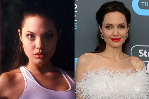Анджелина Джоли до и после ринопластики