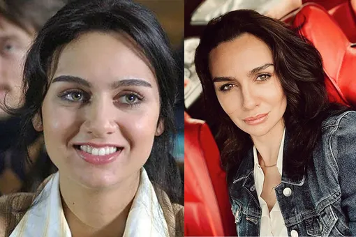 Турецкая актриса Бирдже Акалай до и после пластики