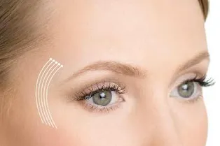 Новая технология деликатной коррекции возрастных изменений