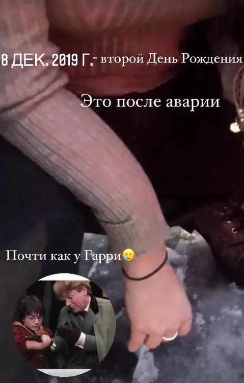Рука Лианы Шульгиной после аварии
