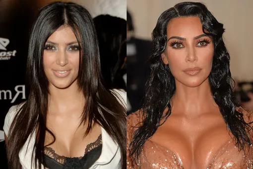 Ким Кардашьян до и после поастики