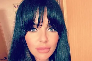 Бывшая солистка группы «Тату» Юлия Волкова вернула себе красивые брови: чего ей это стоило