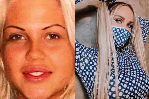 Мария Погребняк до и после пересадки волос