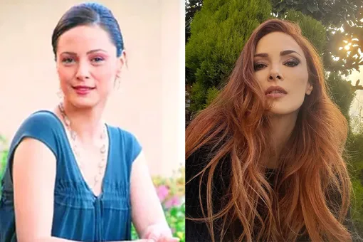 Турецкая актриса Мине Тугай до и после пластики: фото