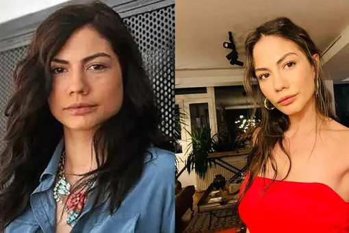 Турецкая актриса Демет Оздемир до и после пластики