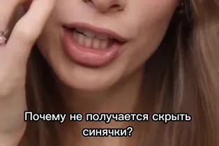 Не получается скрыть синячки? Советы от @julyabay