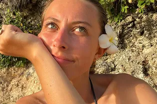 Каким должен быть уход за кожей после загара